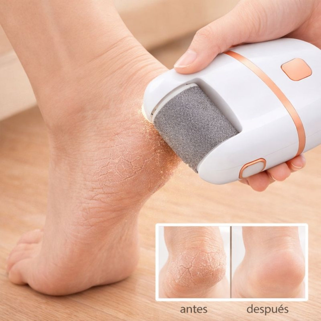 ADIÓS DUREZAS -EXFOLIANTE ELÉCTRICO PARA PIES + RECAMBIOS 🎁